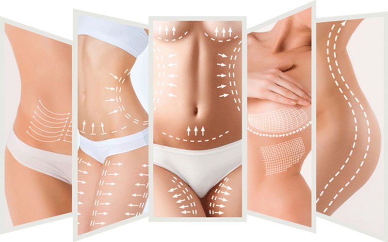 Treatment 2 Slimming Treatment